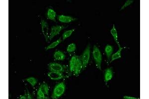 Immunofluorescent analysis of Hela cells using ABIN7163465 at dilution of 1:100 and Alexa Fluor 488-congugated AffiniPure Goat Anti-Rabbit IgG(H+L)