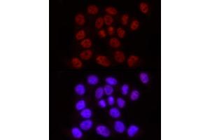 Immunofluorescence analysis of HeLa using Phospho-POLR2A CTD-S2 Rabbit mAb  at dilution of 1:100 (40x lens). (POLR2A/RPB1 anticorps  (pSer2))