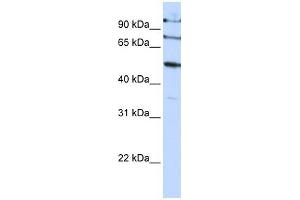 FBXO5 antibody used at 1 ug/ml to detect target protein. (FBXO5 anticorps  (C-Term))