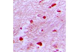 Immunohistochemical analysis of E2F2 staining in human brain formalin fixed paraffin embedded tissue section. (E2F2 anticorps  (Center))