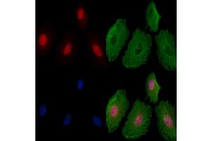 Phospho-hnRNP K (Ser216) Antibody staining A549 cells(4h of LPS treatment) by IF/ICC. (HNRNPK anticorps  (pSer216))