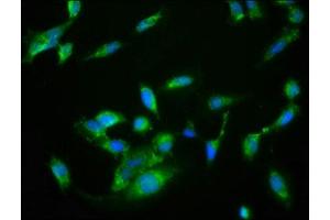 Immunofluorescence staining of Hela cells with ABIN7161918 at 1:133, counter-stained with DAPI.