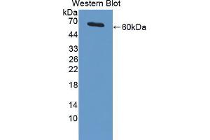 Western blot analysis of the recombinant protein. (PIAS3 anticorps  (AA 11-280))
