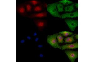 Phospho-VEGFR3 (Tyr1230) Antibody staining A549 cells(4h of LPS treatment) by IF/ICC. (FLT4 anticorps  (pTyr1230))