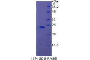 SDS-PAGE analysis of Rat Androgen Receptor Protein.