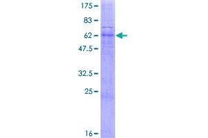 Image no. 1 for Translocation Associated Membrane Protein 2 (TRAM2) (AA 1-370) protein (GST tag) (ABIN1323530)