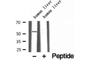 Western blot analysis of extracts of human liver tissue, using TRIM44 antibody. (TRIM44 anticorps  (Internal Region))