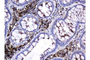 Image no. 15 for anti-Galactosidase, beta 1 (GLB1) antibody (ABIN1498467)