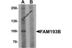 Western Blotting (WB) image for anti-Family with Sequence Similarity 193, Member B (FAM193B) (N-Term) antibody (ABIN1587943) (FAM193B anticorps  (N-Term))