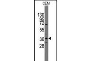 Western blot analysis of anti-Pilx2 Pab in CEM cell line lysates (35ug/lane). (PITX2 anticorps  (AA 122-151))