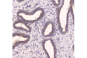 IHC analysis of IDE using anti-IDE antibody .