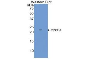 Western blot analysis of the recombinant protein. (LAMC2 anticorps  (AA 28-196))