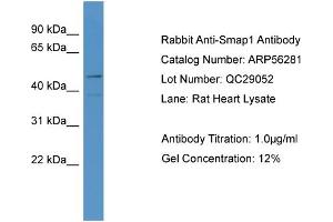 WB Suggested Anti-LOC684800  Antibody Titration: 0.