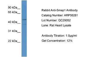 WB Suggested Anti-LOC684800  Antibody Titration: 0. (SMAP1 anticorps  (N-Term))