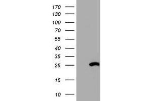 Western Blotting (WB) image for anti-Hydroxysteroid (17-Beta) Dehydrogenase 8 (HSD17B8) (AA 57-261) antibody (ABIN2715556) (HSD17B8 anticorps  (AA 57-261))