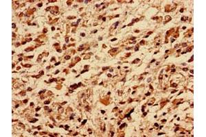 anti-Ribosomal Protein, Large, P0 (RPLP0) (AA 1-317) antibody