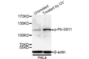 Western blot analysis of extracts of 293 and HeLa cells, using Phospho-Rb-S811 antibody. (Retinoblastoma 1 anticorps  (pSer811))