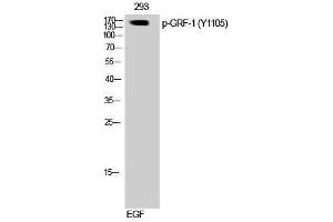Western Blotting (WB) image for anti-Glucocorticoid Receptor DNA Binding Factor 1 (GRLF1) (pTyr1105) antibody (ABIN6288252)