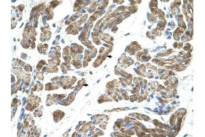 ACVR1 antibody was used for immunohistochemistry at a concentration of 4-8 ug/ml to stain Skeletal muscle cells (arrows) in Human Muscle.