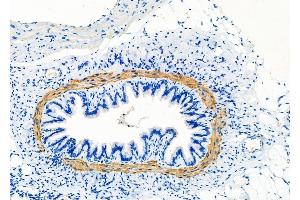 ABIN6260910 and ABIN6277858 at 1/100 staining Rat lung tissue by IHC-P. (Calponin anticorps  (N-Term))