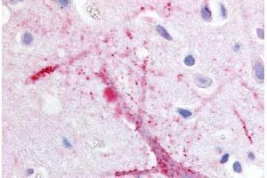 Human Brain, Cortex (formalin-fixed, paraffin-embedded) stained with GPRC5B antibody ABIN213465 at 20 ug/ml followed by biotinylated goat anti-rabbit IgG secondary antibody ABIN481713, alkaline phosphatase-streptavidin and chromogen.