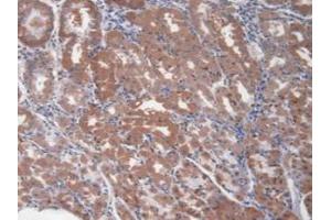 Detection of Kim1 in Human Stomach Tissue using Monoclonal Antibody to Kidney Injury Molecule 1 (Kim1)