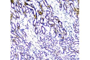 IHC analysis of TANK using anti-TANK antibody (ABIN6719508). (TANK anticorps)