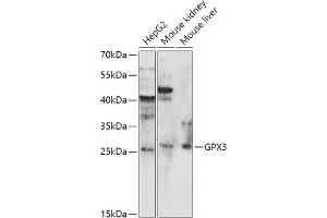 Western blot analysis of extracts of various cell lines, using GPX3 antibody (ABIN6132830, ABIN6141369, ABIN6141370 and ABIN6216780) at 1:1000 dilution. (GPX3 anticorps)