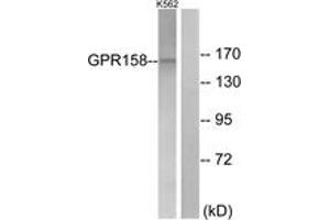 Western Blotting (WB) image for anti-G Protein-Coupled Receptor 158 (GPR158) (AA 1-50) antibody (ABIN2890856) (GPR158 anticorps  (AA 1-50))