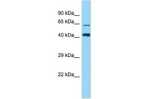 Western Blotting (WB) image for anti-Zinc Finger Protein 667 (ZNF667) (N-Term) antibody (ABIN2778606) (ZNF667 anticorps  (N-Term))