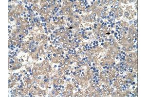 C3ORF10 antibody was used for immunohistochemistry at a concentration of 4-8 ug/ml. (BRK1 anticorps  (Middle Region))