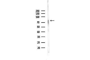 Western blot analysis of lysates from HepG2 cells(heat-shock,45 min treatment), using Phospho-Progesterone Receptor (Ser294) Antibody at 1/1000 dilution.