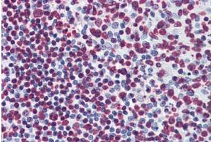 Human Tonsil: Formalin-Fixed, Paraffin-Embedded (FFPE)