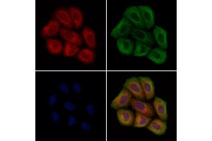 ABIN7094636 and ABIN7098686 staining Hela cells by IF/ICC. (STARD7 anticorps  (C-Term))