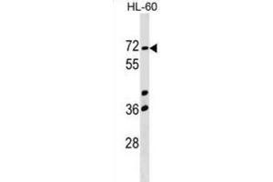 Western Blotting (WB) image for anti-Calicin (CCIN) antibody (ABIN2999591) (Calicin anticorps)
