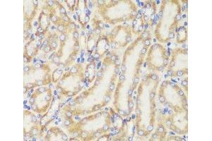 Immunohistochemistry of paraffin-embedded Mouse kidney using TOM20 Polyclonal Antibody at dilution of 1:100 (40x lens).
