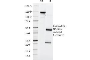 SDS-PAGE Analysis Purified Lewis Y Mouse Monoclonal Antibody (A70-A/A9). (Blood Group Lewis Y anticorps)