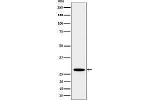 Western blot analysis of PSMB10 expression in Daudi cell lysate.