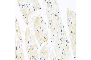 Immunohistochemistry of paraffin-embedded rat heart using TAF9 antibody (ABIN5971055) at dilution of 1/100 (40x lens). (TAF9 anticorps)