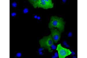 Immunofluorescence (IF) image for anti-SHC (Src Homology 2 Domain Containing) Transforming Protein 1 (SHC1) antibody (ABIN1499993)