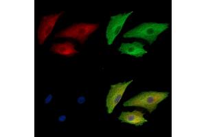 ABIN7095079 and ABIN7099135 staining  cells by IF/ICC. (KRIT1 anticorps)