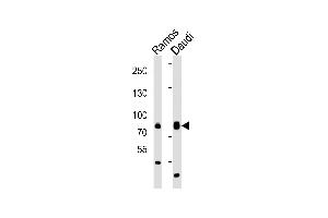Western blot analysis of lysates from Ramos, Daudi cell line (from left to right), using TEC Antibody (Center) (ABIN6242484 and ABIN6577833).