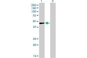 Western Blot analysis of TFAP2A expression in transfected 293T cell line by TFAP2A monoclonal antibody (M01), clone 2G5.