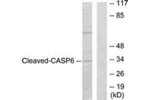 Western blot analysis of extracts from 293 cells, treated with Etoposide 25uM 60', using Caspase 6 (Cleaved-Asp162) Antibody. (Caspase 6 anticorps  (Cleaved-Asp162))