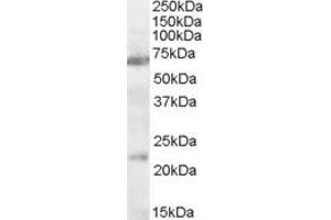 Western Blotting (WB) image for anti-Cholinergic Receptor, Nicotinic, alpha 4 (CHRNA4) (AA 29-43) antibody (ABIN490506) (CHRNA4 anticorps  (AA 29-43))