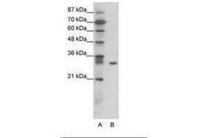 Image no. 1 for anti-NF-kappa-B inhibitor beta (NFKBIB) (AA 49-98) antibody (ABIN6736066) (NFKBIB anticorps  (AA 49-98))