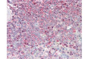 Anti-MSN / Moesin antibody IHC staining of human spleen. (Moesin anticorps  (AA 292-491))