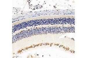 Immunohistochemistry of paraffin embedded mouse eye using NACAD (ABIN7074756) at dilution of 1:1000 (250x lens)