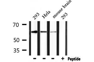 Western blot analysis of extracts from 293, Hela and mouse brain, using RANGAP1 Antibody. (RANGAP1 anticorps  (N-Term))