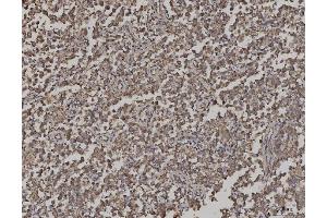 IHC analysis of ARL13B using anti-ARL13B antibody (ABIN7600179).